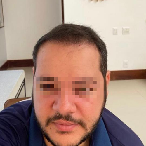Resultados