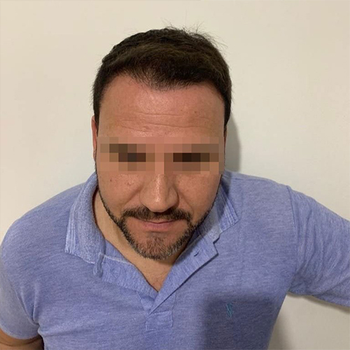 Resultados
